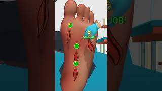 Foot Clinic Treatment Satisfying ASMR Mobile Game#shorts