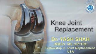 Do you need Knee replacement surgery?Look no further, visit Bodyline & consult Dr. Yash Shah(Ortho)!