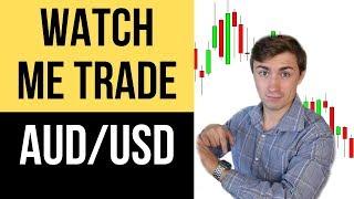 Forex Trading Live: Watch me Trade AUD/USD Start to Finish! 