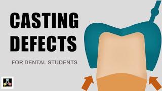 Dental Casting defects