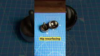 Hip replacement vs hip resurfacing #hipsurgery #arthritis #hipreplacement ##hipresurfacing