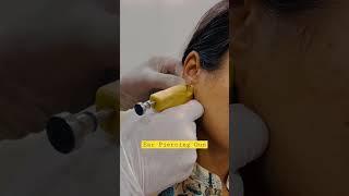 Ear piercing gun| Dr Nakul Somani| #shortsvideo #plasticsurgeon #shortsfeed #cosmeticsurgery #jaipur