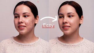 Easy Face Retouching - Best Photoshop Tutorial | Skin Retouching