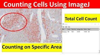 How to Count Cells Using ImageJ | How to Count Cells in Imagej | Imagej Cell Counting |