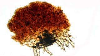 Tactile camouflage in a mite species of the Histiostomatidae