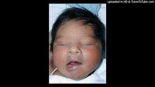 Idiopathic Non-traumatic Facial Nerve Palsy (Bell’s Palsy) in Neonates