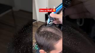 LIES OR LICE?  #barber #haircut #funny #prank #lies