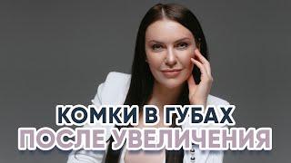 Комки в губах после увеличения