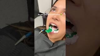 Dentists: Get rid of messy impressions  call to find out how