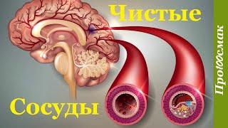 Чем почистить сосуды. Как очистить сосуды