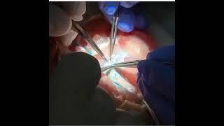 UW visiting Medical student Cole Roblee microsurgery intro