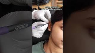Helix Piercing