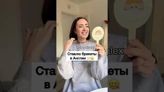 Лечу Зубы по Фото в Англии  - ЗАЦЕНИ!