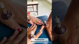 Moxibustion therapy. #naturopathy #yoga