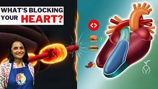  The HIDDEN Truth About 🫀 CHOLESTEROL & HEART BLOCKAGES!  | Shoba Swamy |  PLANT-BASED NUTRITION