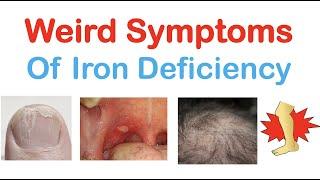 Weird Symptoms of Iron Deficiency | Nails, Tongue, Skin, Hair & Others