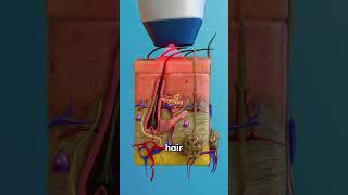 How A Laser Hair Removal Works 