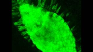 Dynamics of Drosophila Dorsal Closure