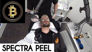 АППАРАТНАЯ КОСМЕТОЛОГИЯ – ЗАЧЕМ Я СДЕЛАЛ ПРОЦЕДУРУ SPECTRA PEEL. КРИПТОДЕПУТАТ-НАТУРАЛ НА БЬЮТИ.