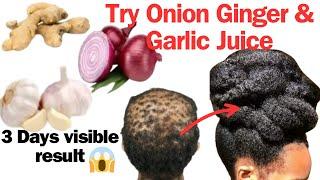 Your Hair Will Grow 10X  Faster With Onion, Ginger and  Garlic. Quickest Solution For Baldness