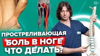 Почему боль в пояснице отдает в ногу? Как лечить защемление седалищного нерва? //16+