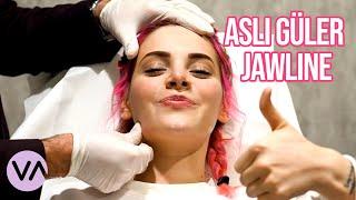 Aslı Güler Jawline Dolgusu | Vanity Estetik #Jawline #Dolgu @asliguler