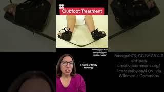 Clubfoot: Pediatrics SHORT | @LevelUpRN