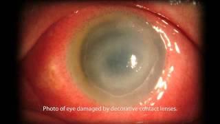 American Academy Of Ophthalmology