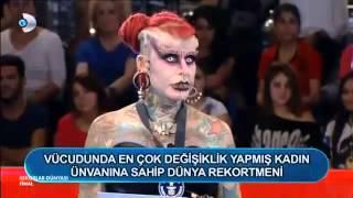Bedeninde en cox plastik emeliyyat etmis xanim