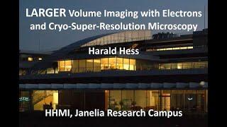 Dr Hess - Larger Volume Imaging with Electrons and Cryo-Super-Resolution Microscopy