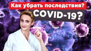 COVID-19. Постковидный синдром