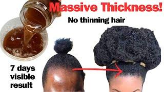 THE MOST EFFECTIVE HAIRLOSS REMEDY Stops Hair Thinning and Thickens Hair. How to Stop Hairloss