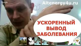 Катушка Мишина: ускоренный вывод заболевания через кожу