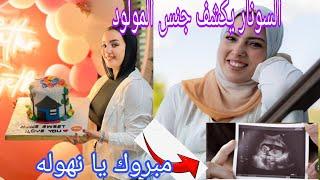 أول سونار لوفاء يكشف جنس المولود حمل نهال في الشقه الجديده قدم السعد️