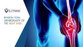 REVISION TOTAL ARTHROPLASTY OF THE RIGHT KNEE l Vejthani Hospital