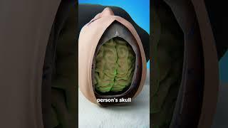 Is It Possible To Swap Brains? 