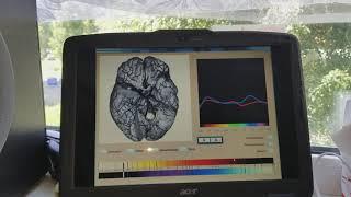 Bioptron +riposol