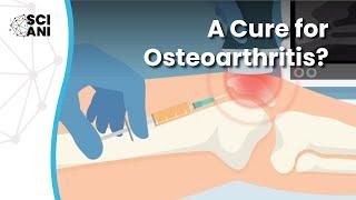 Breakthroughs in Osteoarthritis treatment