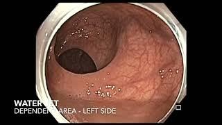 Colon-Colonoscopy-Rectum-Defining anterior wall