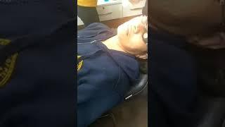 Treatment of acne scars Ice pick scars...through mono threads
