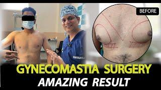 Amazing Gynecomastia Surgery Results | Patient Feedback Post-Surgery | Rejuvena Cosmo Care