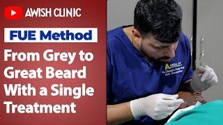 The Ultimate White Beard Transformation | White Beard Treatment | Awish Clinic | #viral #whitebeard