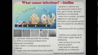 Infections and medical devices - applying research to improve outcomes - Knowledge Works