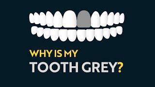 Why is My Tooth Grey?