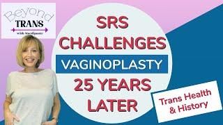 MY SRS (Vaginoplasty) CHALLENGES - DECADES LATER | Transgender MTF Transition