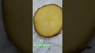 TS Dicot stem (Potato tuber)