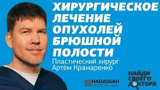 Хирургическое лечение опухолей брюшной полости: Алексей Богданов, хирург, онколог клиники "Хадасса"