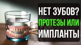 Нет ни одного зуба! Зубные Протезы или Импланты при полном отсутствии зубов?