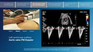 Advanced screening views of the fetal heart - Part 3 - Left ventricular outflow color and PW Doppler