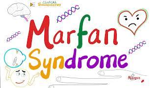 Marfan Syndrome - Causes, Symptoms, Diagnosis, and Treatment - Genetics